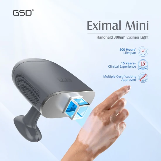 308nm Excimer Terapia de luz Láser LED 308nm Psoriasis Vitiligo Máquina láser Luz UVB 308 Nm Lámpara UV Eximal Mini