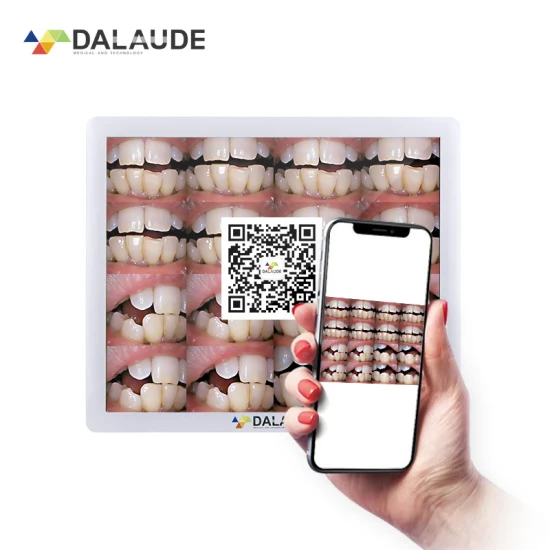 Cuidado dental Cámara intraoral Dispositivo USB Almacenamiento